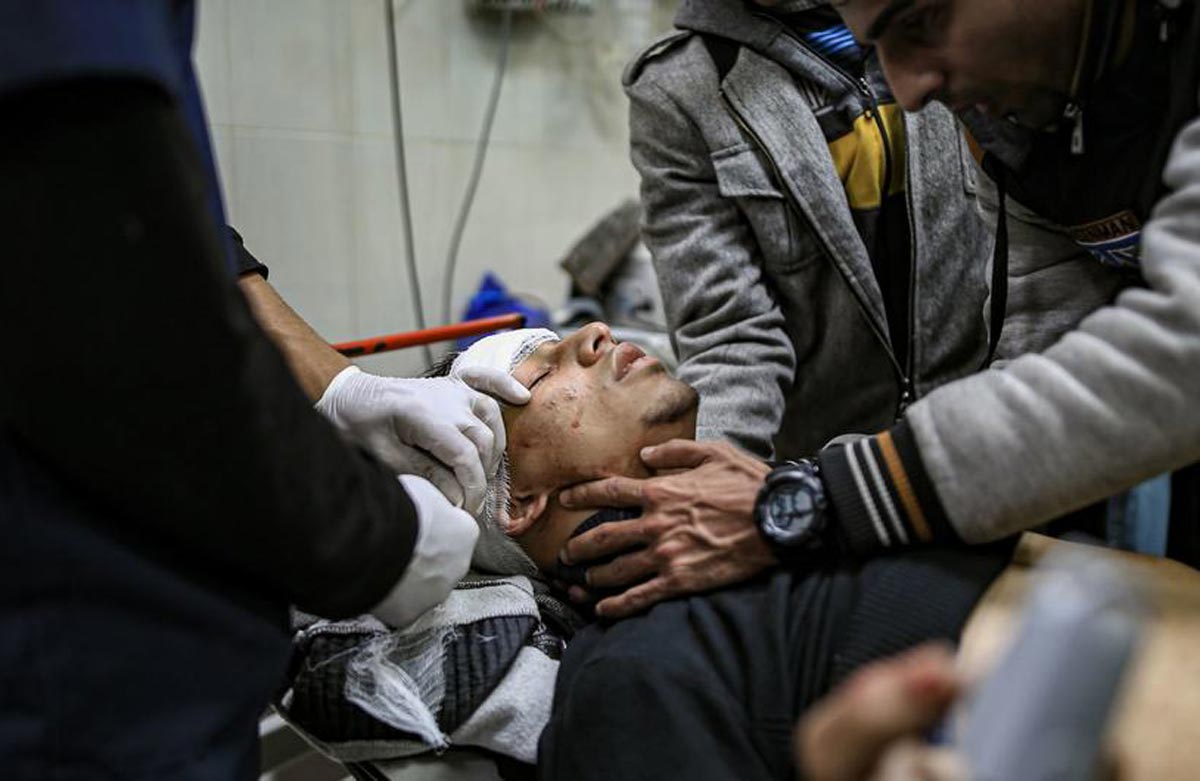 Un hombre palestino herido es atendido en el Complejo Médico Nasser en Khan Younis en enero de 2024.